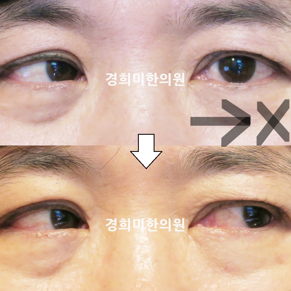45번-14006-강강-표시.jpg