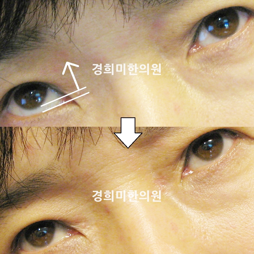 46번-13306-강중.jpg