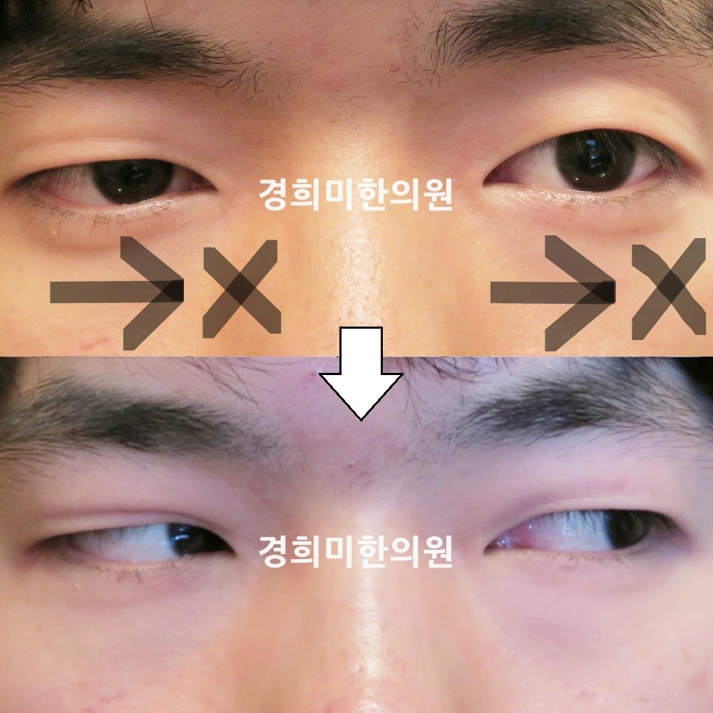 49번-14315-2-강강-표시.jpg