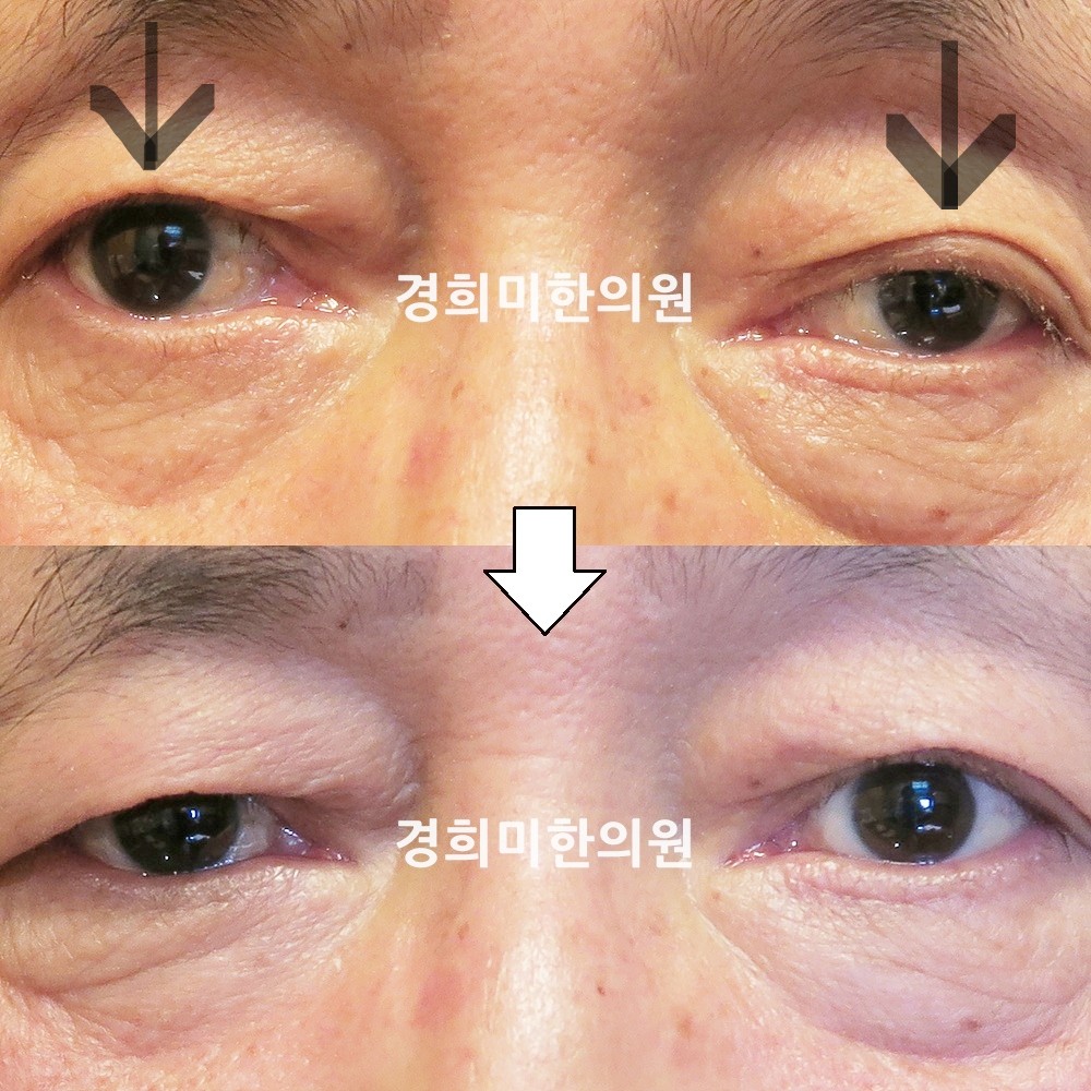 50번-14377-강강-표시.jpg