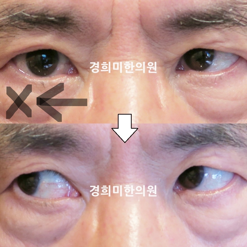 52번-14307-강강-표시.jpg