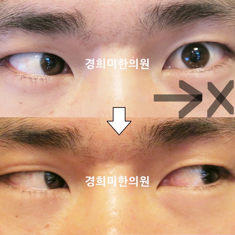 54번-14210-2-강강약-표시.jpg