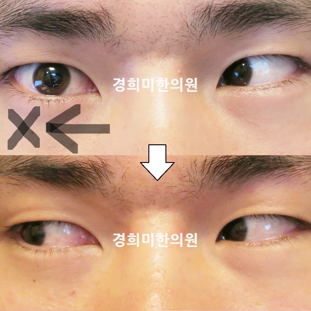 54번-14210-1-강강약-표시.jpg