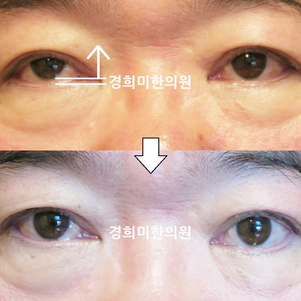 56번-14691-강강약.jpg
