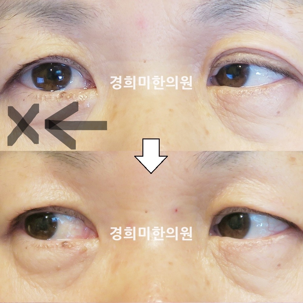 57번-14641-강중-표시.jpg