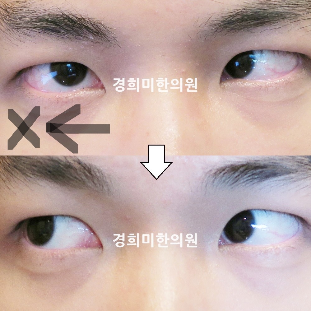 59번-14872-강강약-표시.jpg