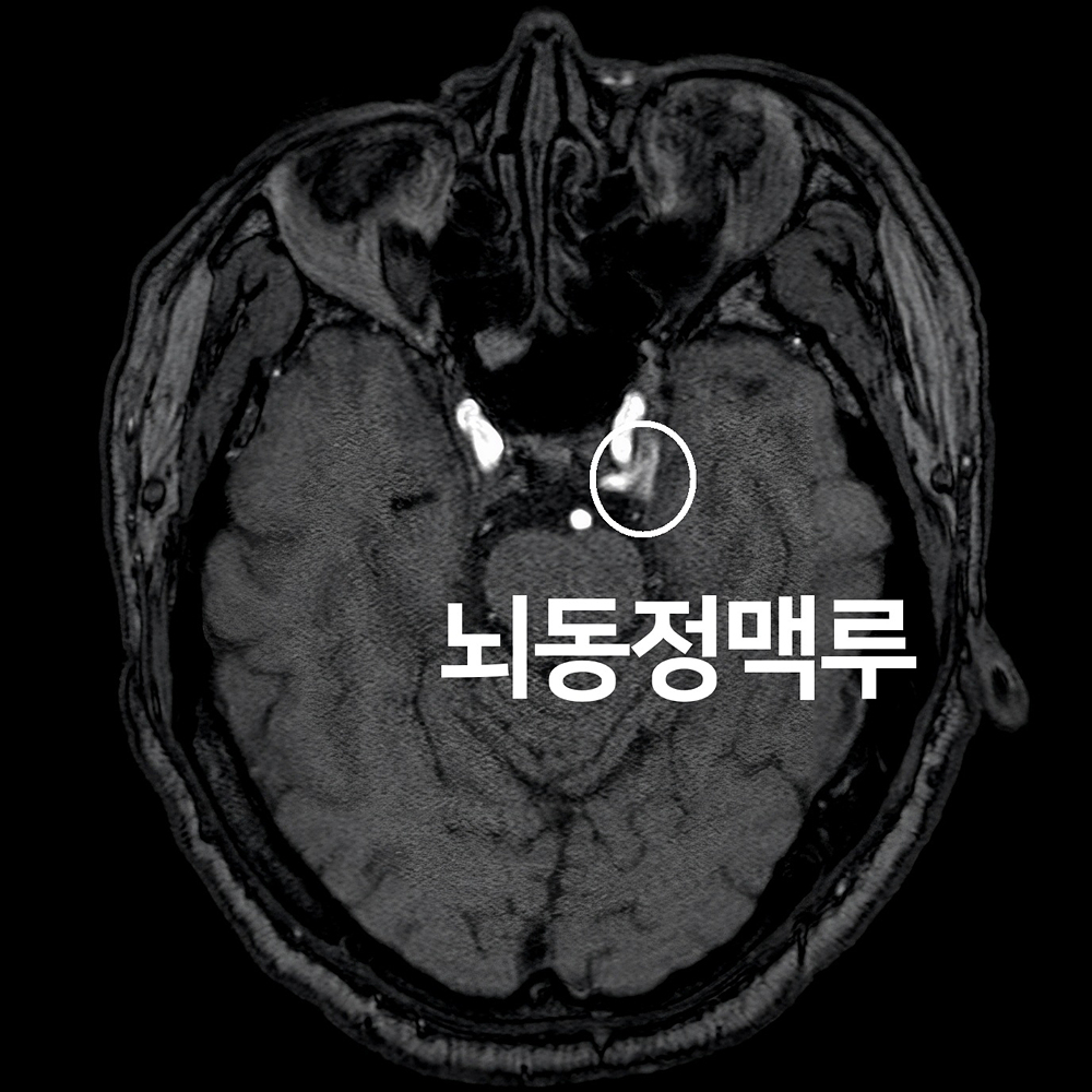 26번-13028-MRI3.jpg