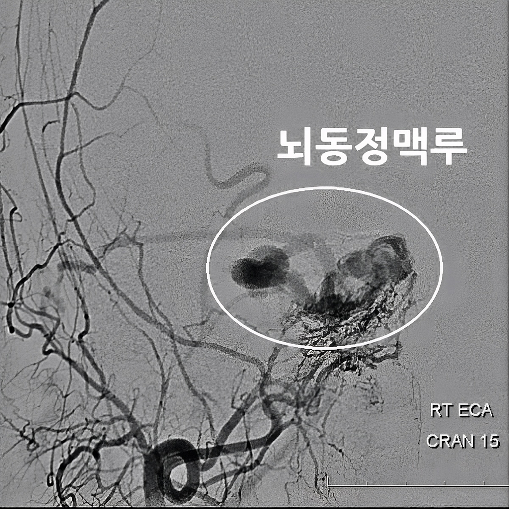 60번-14878-4-표시3.jpg