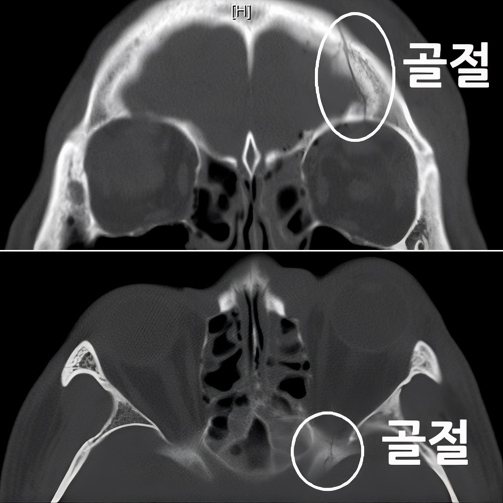 61번-14964 ct3-크게.jpg