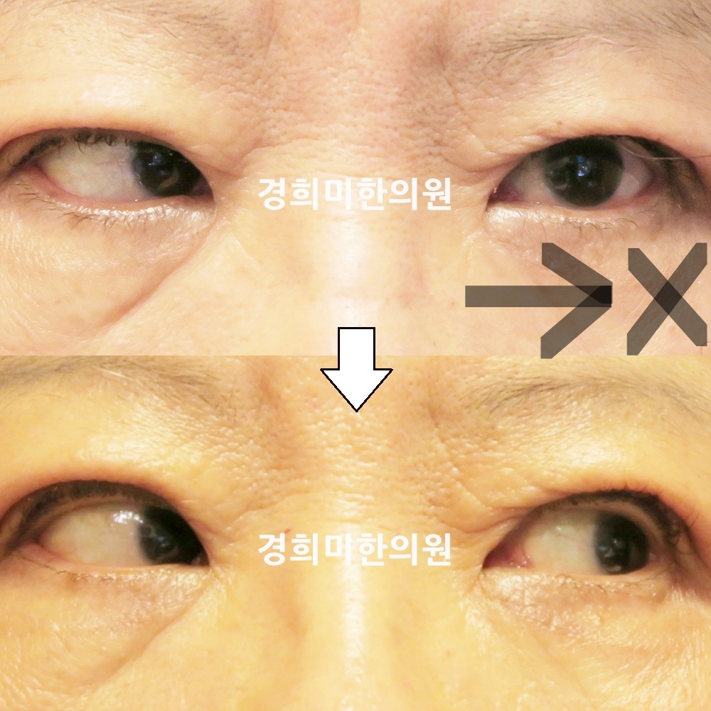 62번-15106-강강중-표시.jpg