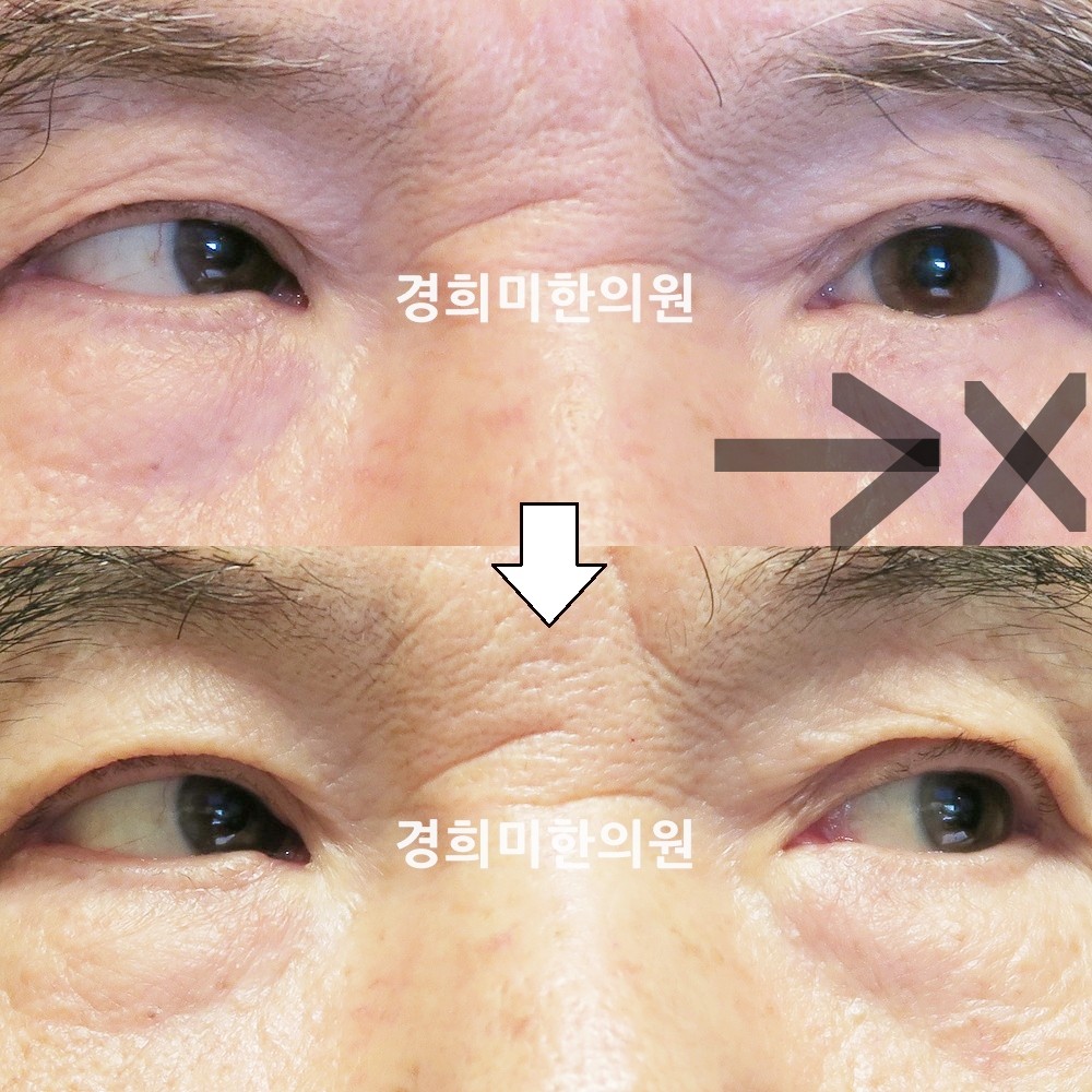 64번-15276-강강약-표시.jpg
