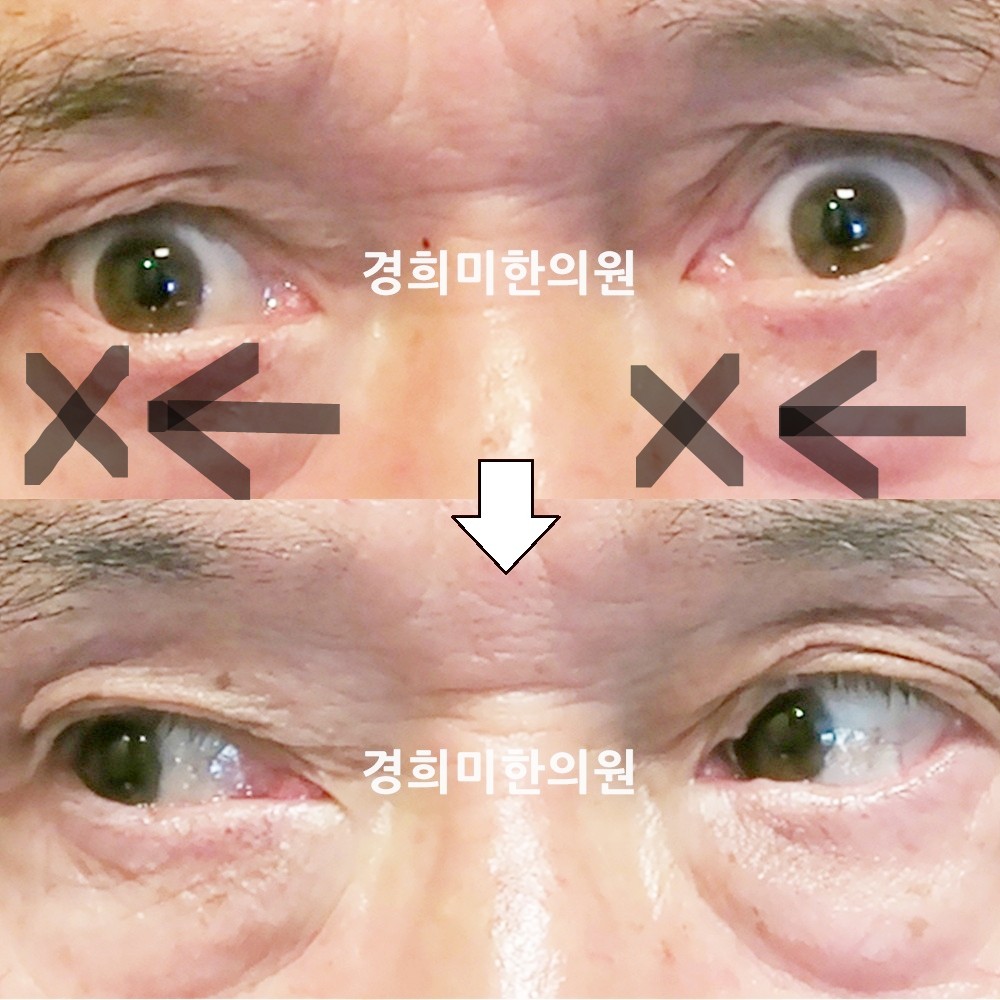 69번-15296-1-강강중-표시.jpg