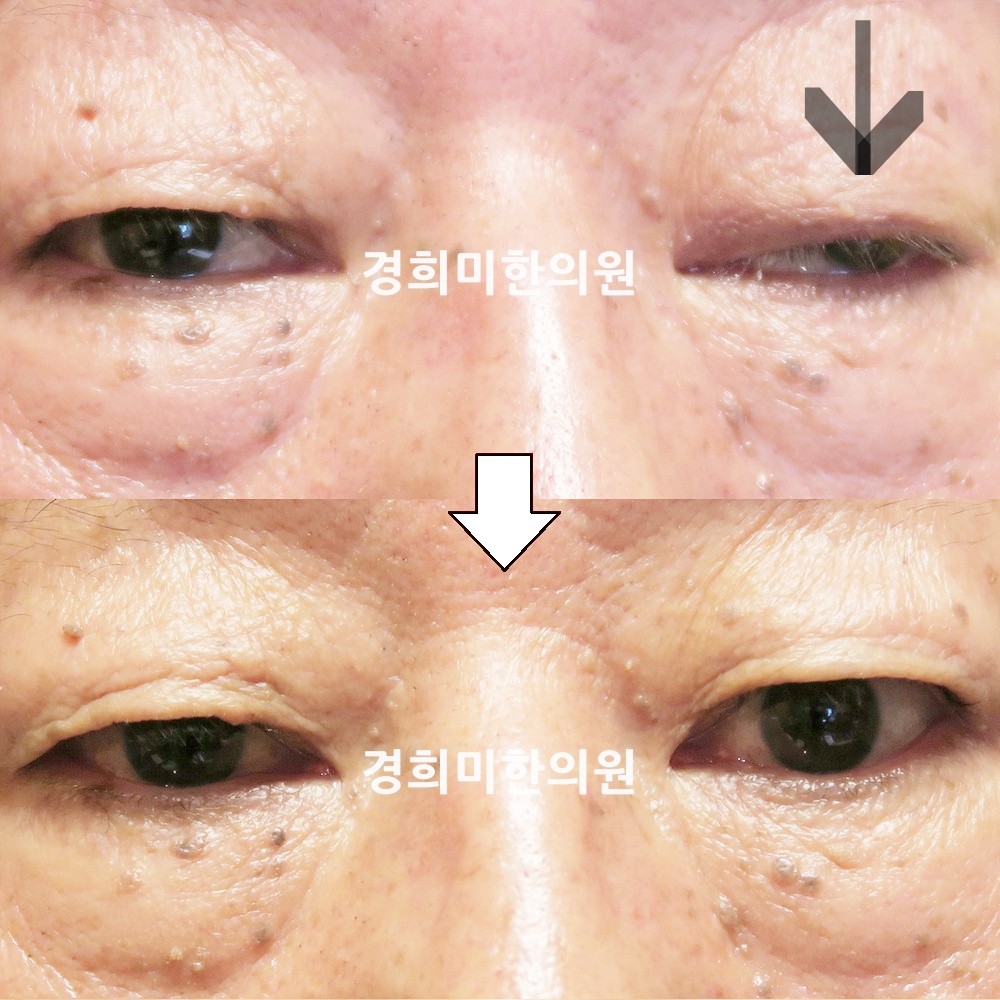 71번-15594-강강중-표시.jpg