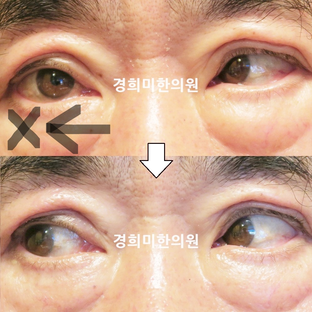 80번-16108-강강중-표시.jpg
