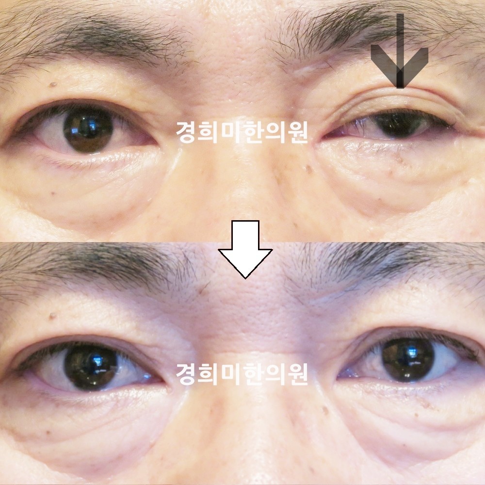 82번-16564-강강중-표시.jpg