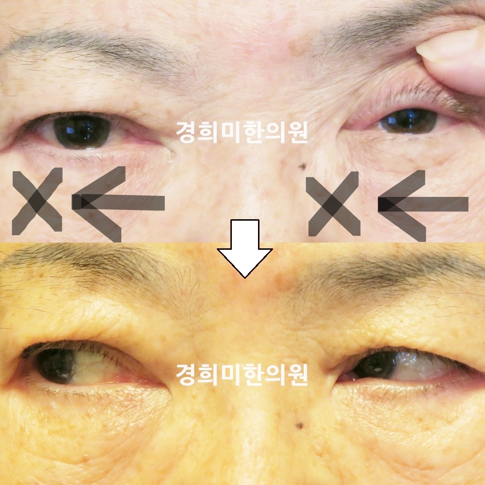 83번-16584-1-강강중-표시.jpg