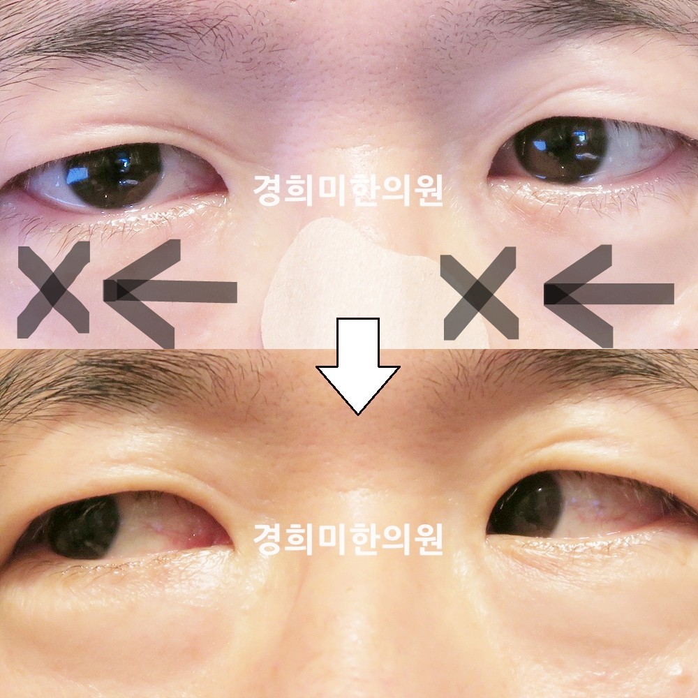 87번-16575-1-강강중-표시.jpg