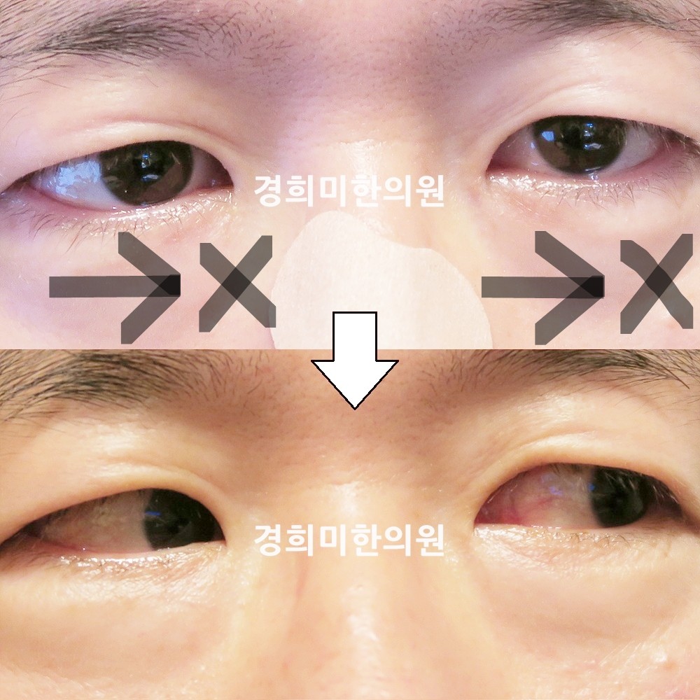 87번-16575-2-강강중-표시.jpg