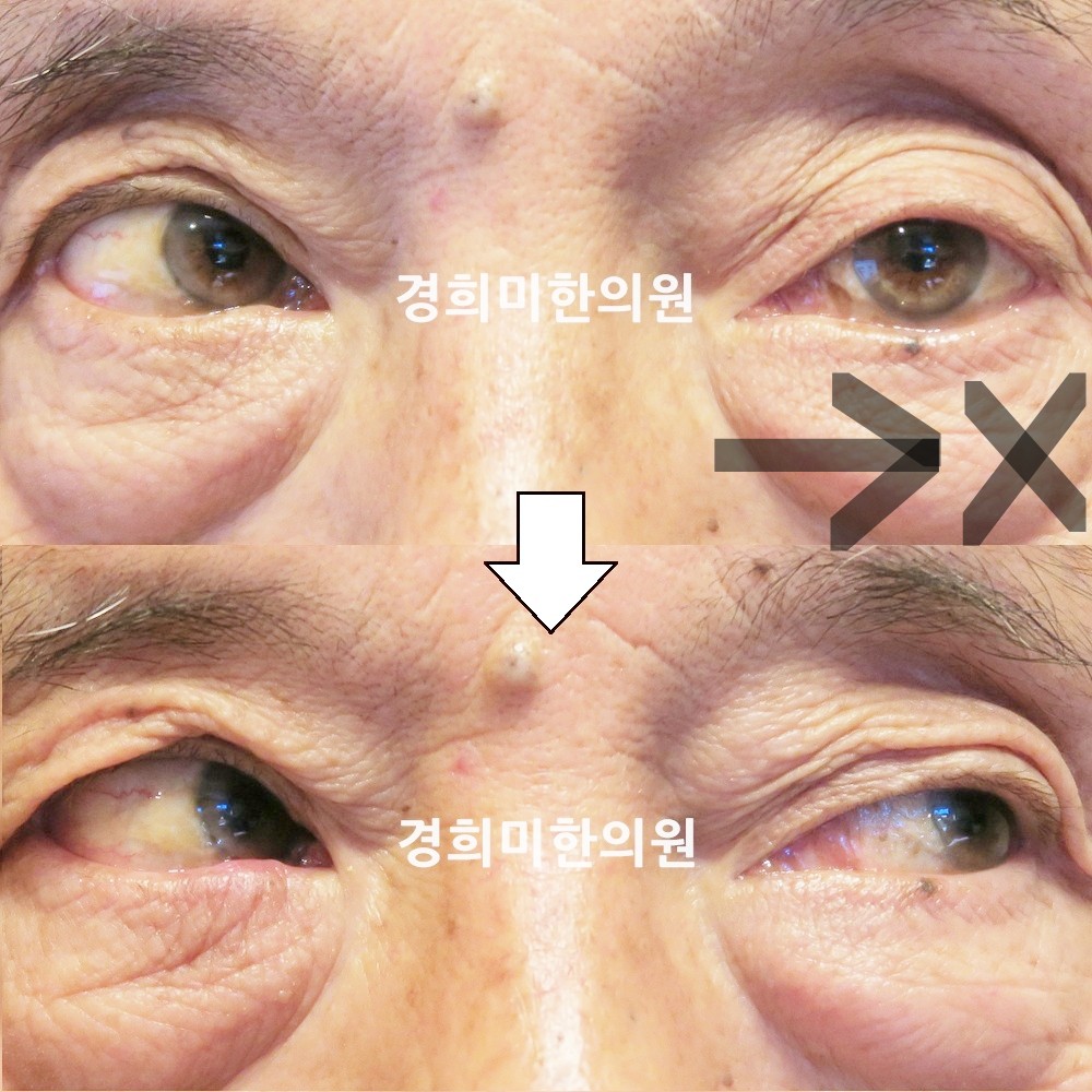 88번-16659-강강중-표시.jpg