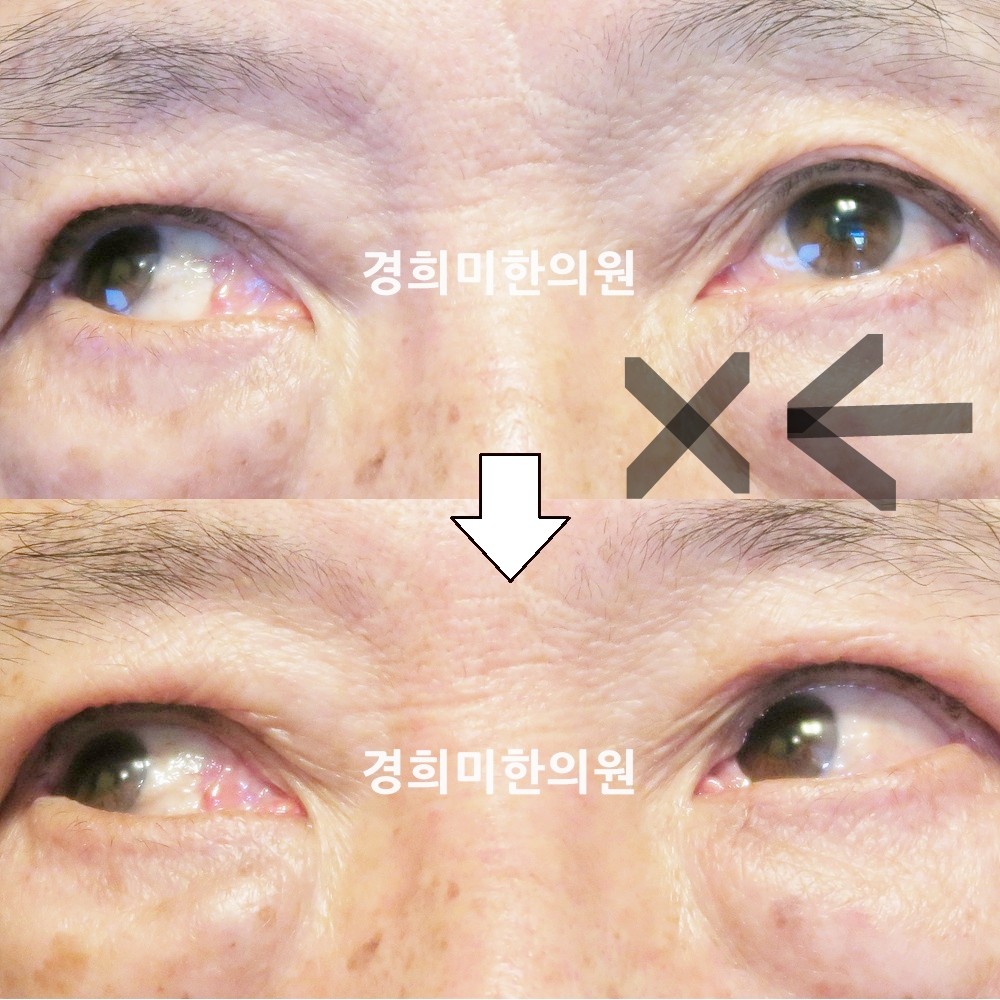 93번-17061-1-강강중-표시.jpg