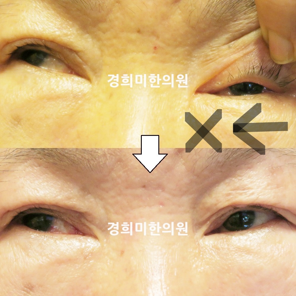98번-13710-2-강강중(19년)-표시.jpg