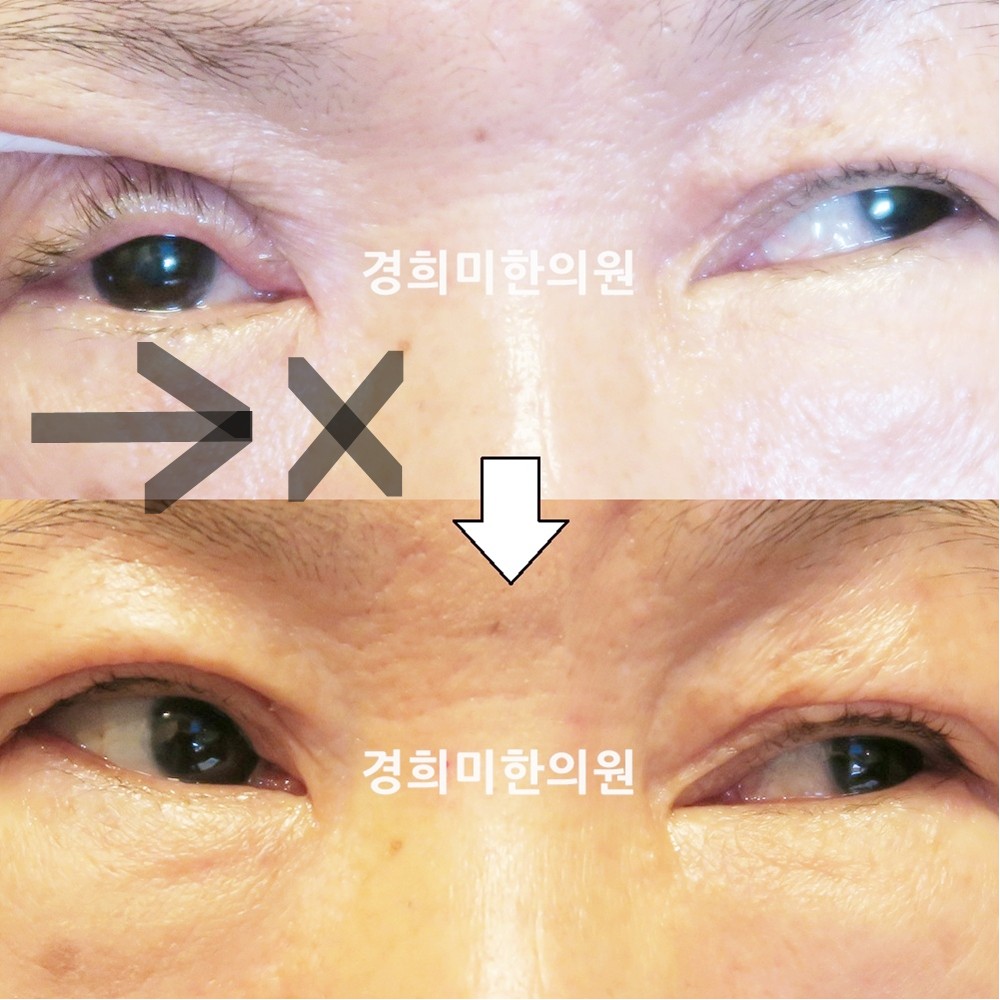 98번-13710-1-강강약(16년12월)-표시.jpg