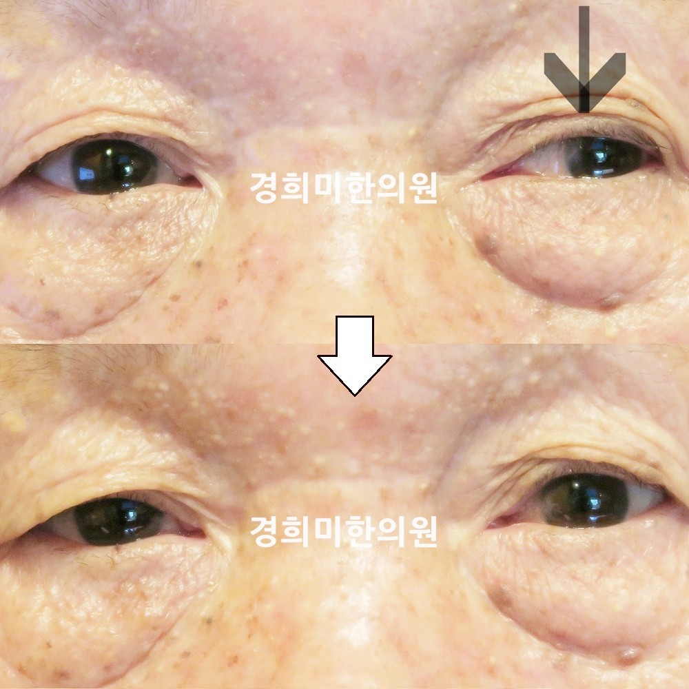 100번-17777-2-강강중-표시.jpg