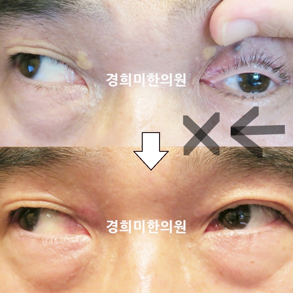 102번-17902-1-강강중-표시.jpg