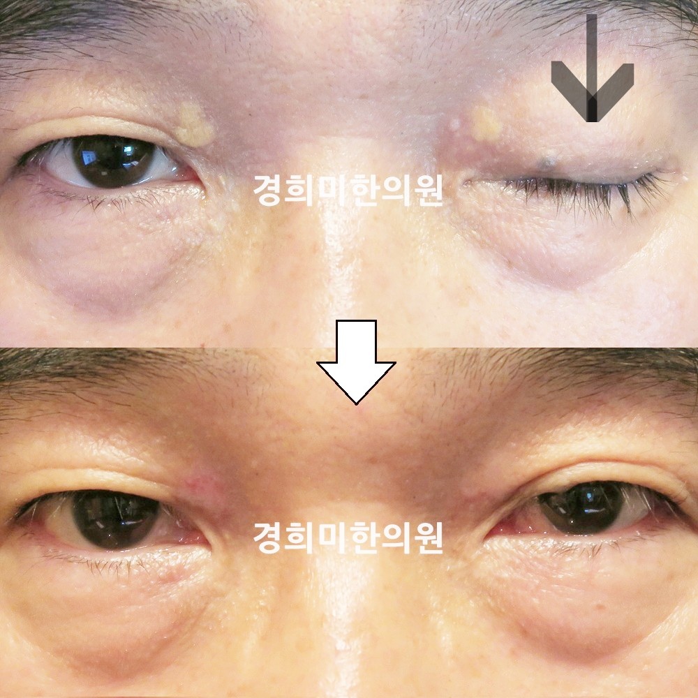 102번-17902-2-강강중-표시.jpg