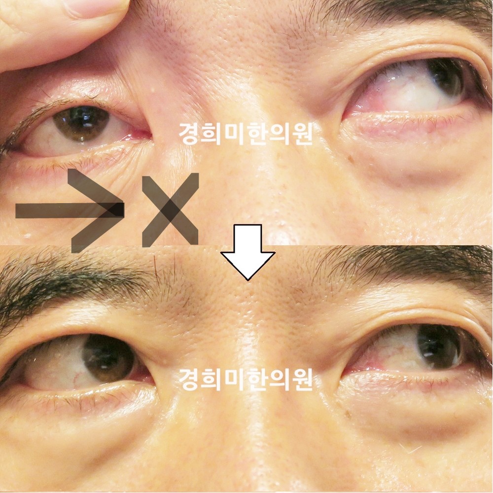 109번-18460-1-강강중-표시.jpg