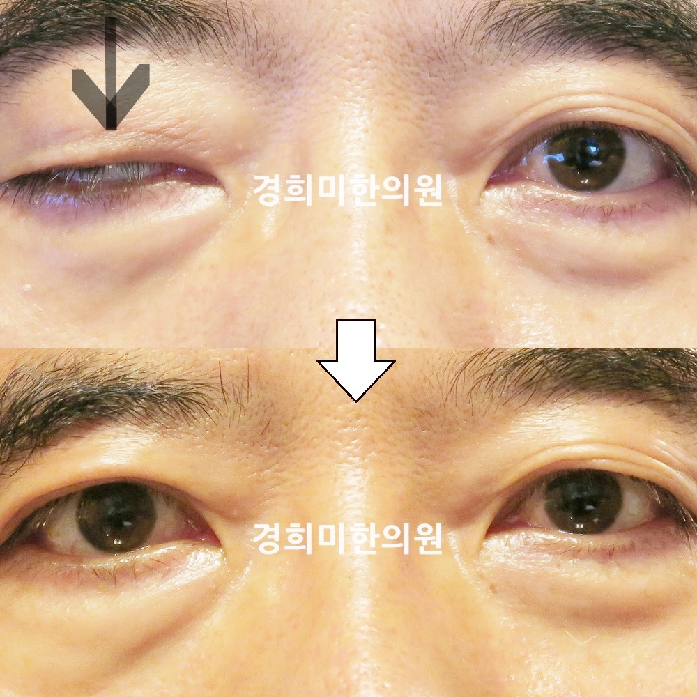 109번-18460-2-강강중-표시.jpg