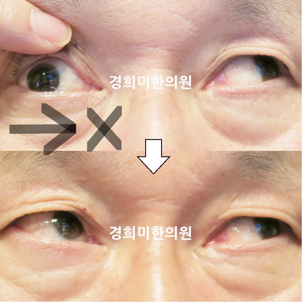 110번-18615-1-강강중-표시.jpg