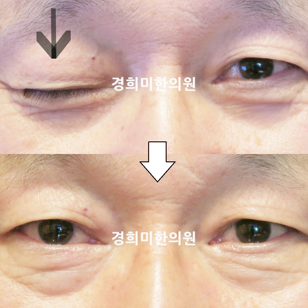 110번-18615-2-강강중-표시.jpg