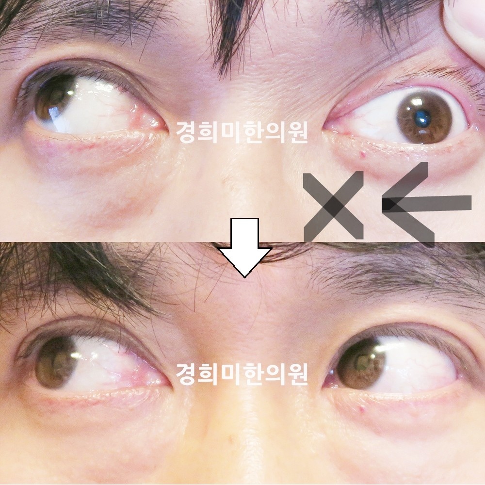 108번-15234-1-강중-표시.jpg