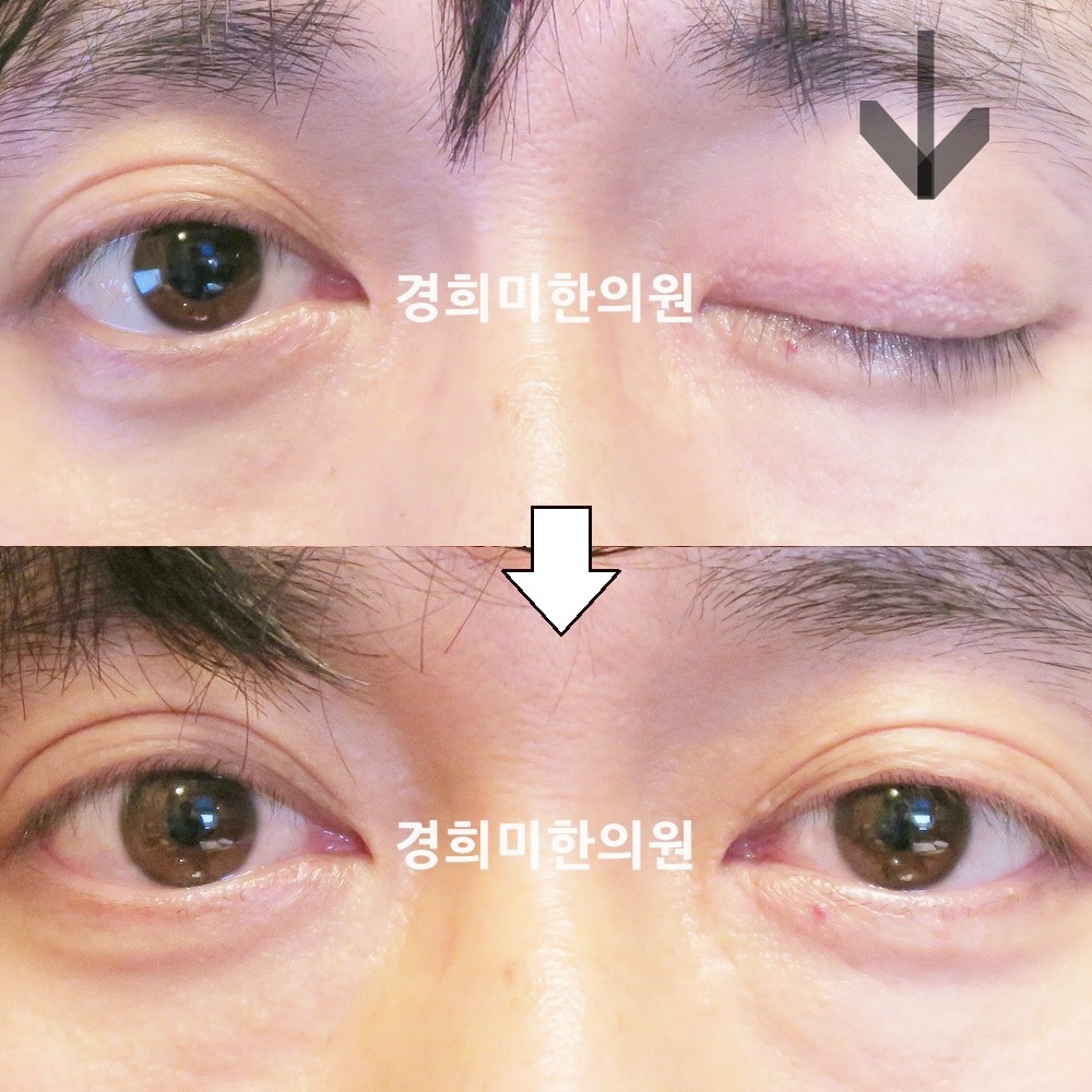 108번-15234-2-강강중-표시.jpg
