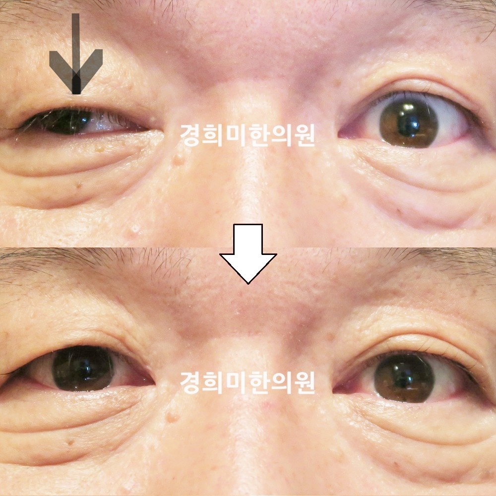 111번-18617-강강중-표시.jpg