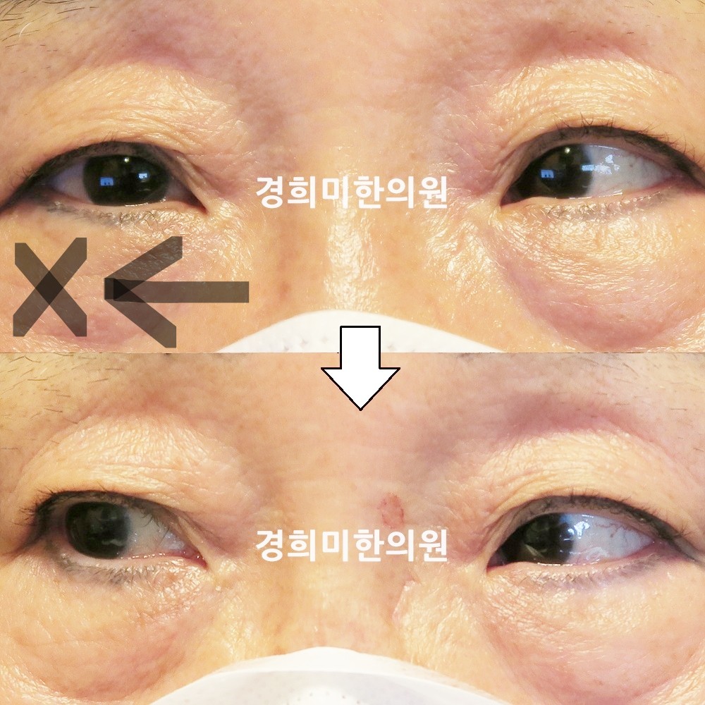 115번-19375-강강중-표시.jpg