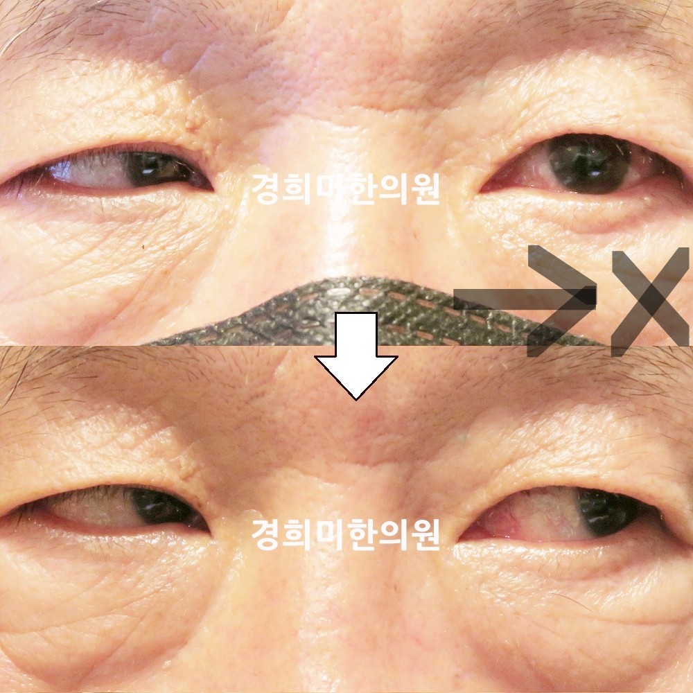 119번-19842-강강강-표시.jpg