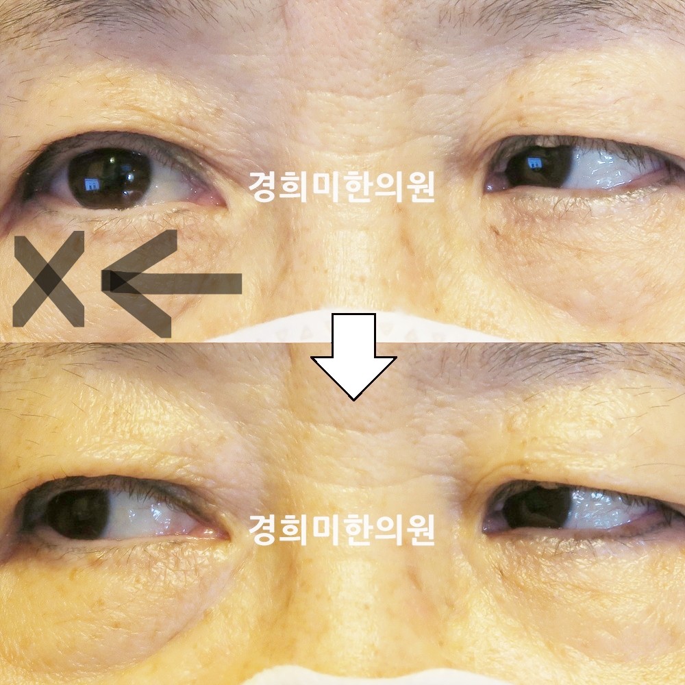 120번-19245-강강중-표시.jpg