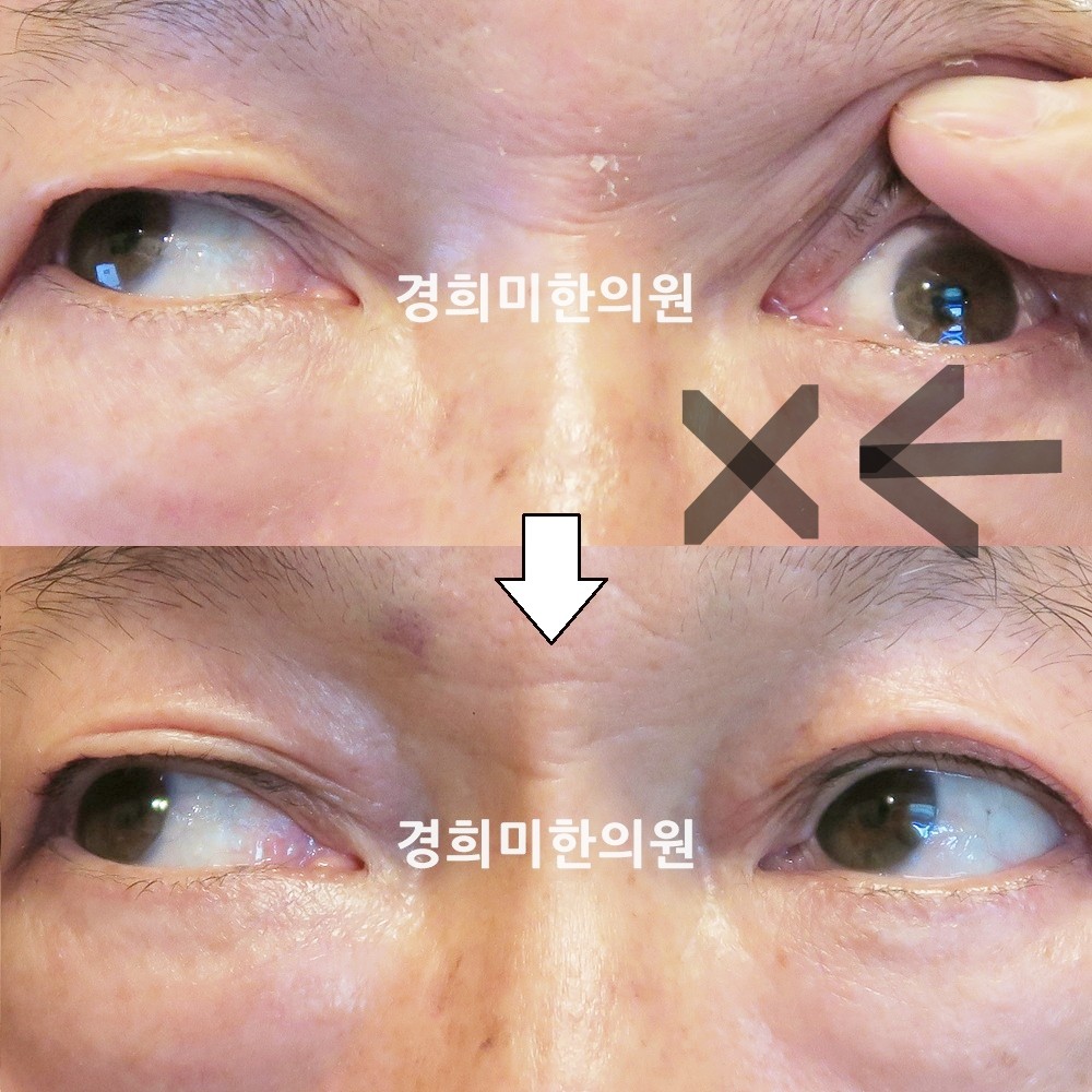 112번-13953-2-강강-표시.jpg