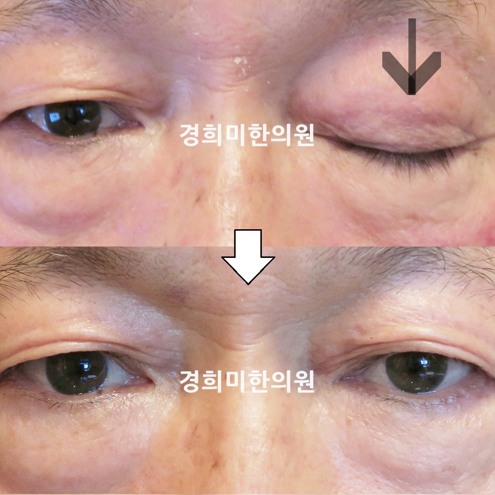 112번-13953-1-강강-표시.jpg