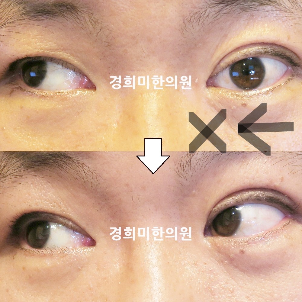 121번-20247-강강강-표시.jpg