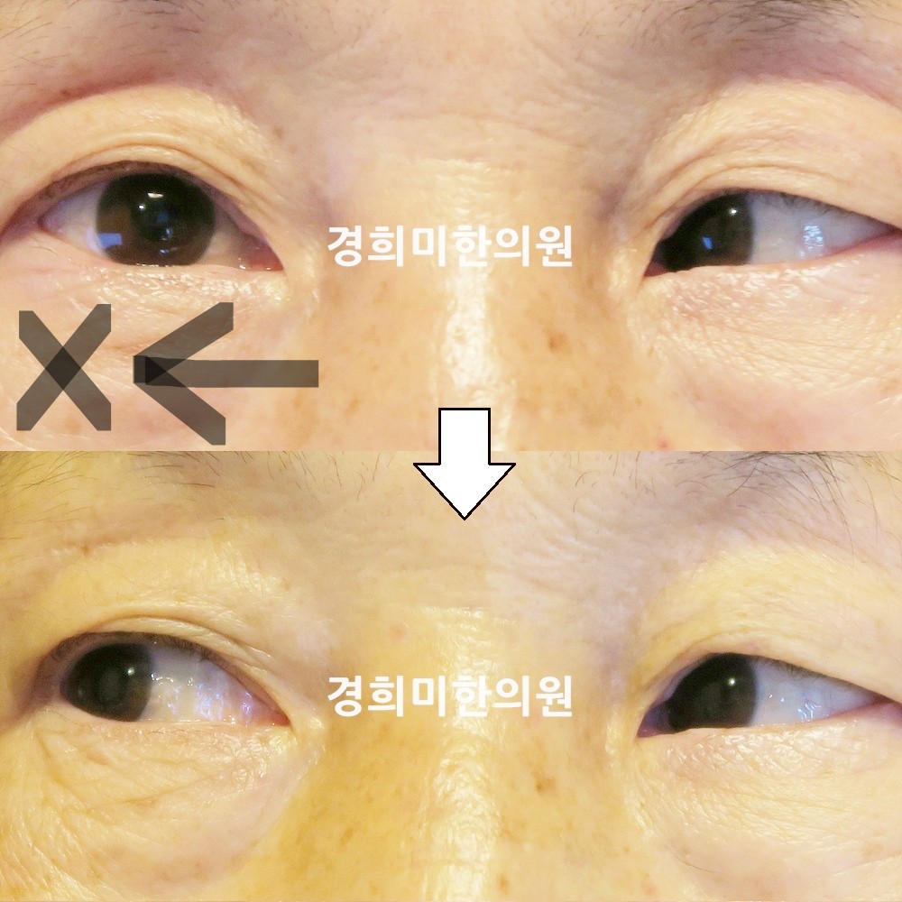 122번-21125-강강중-표시.jpg