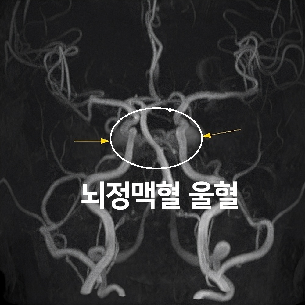 122번-전명순 MRI5.jpg