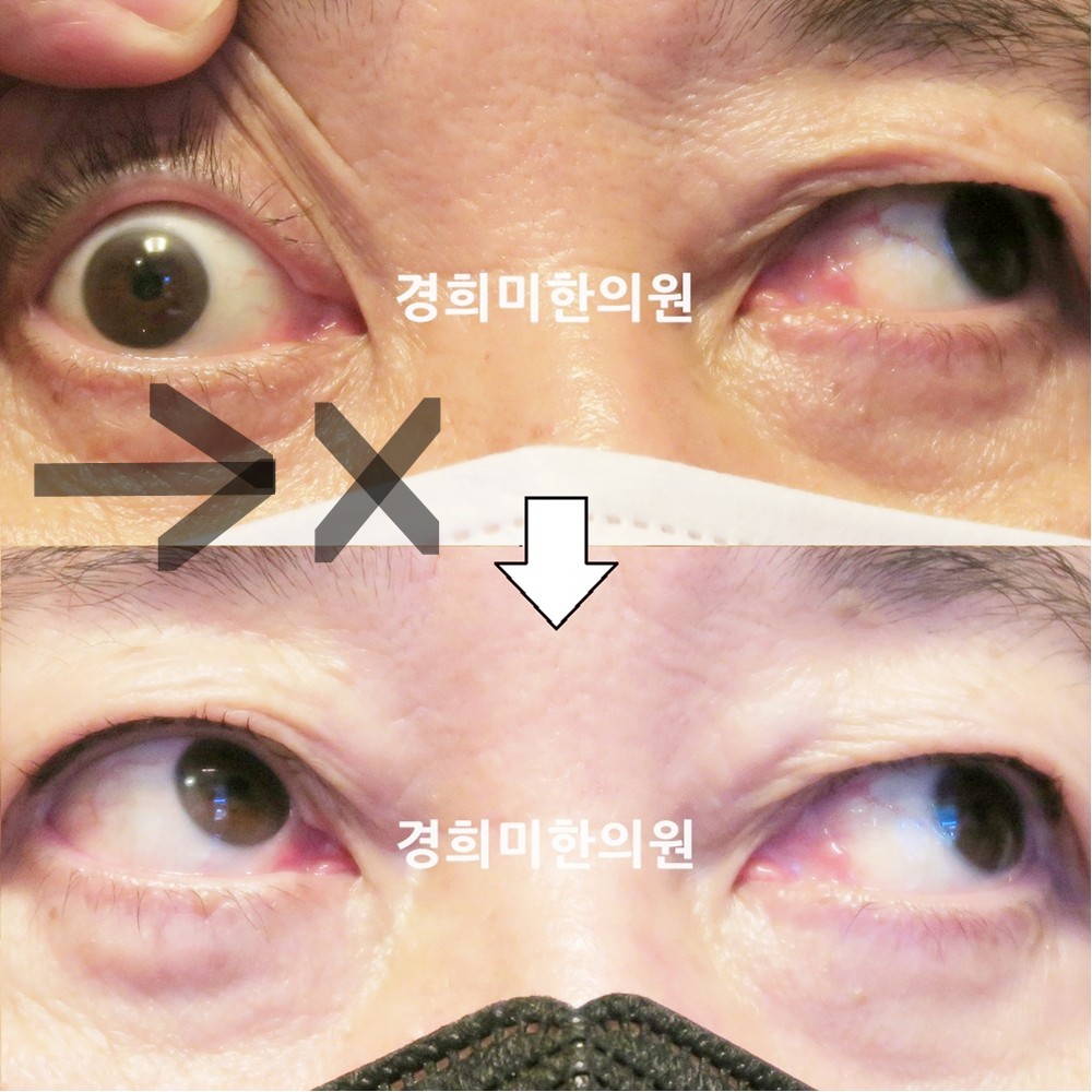 123번-21031-1-강강중-표시.jpg