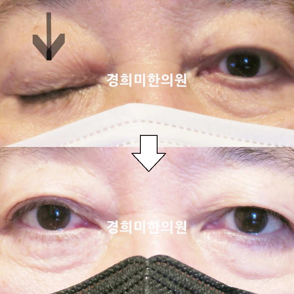 123번-21031-2-강강중-표시.jpg