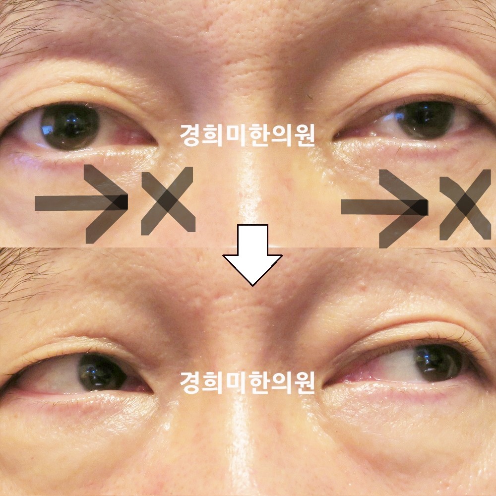 124번-21317-2-강강강-표시.jpg