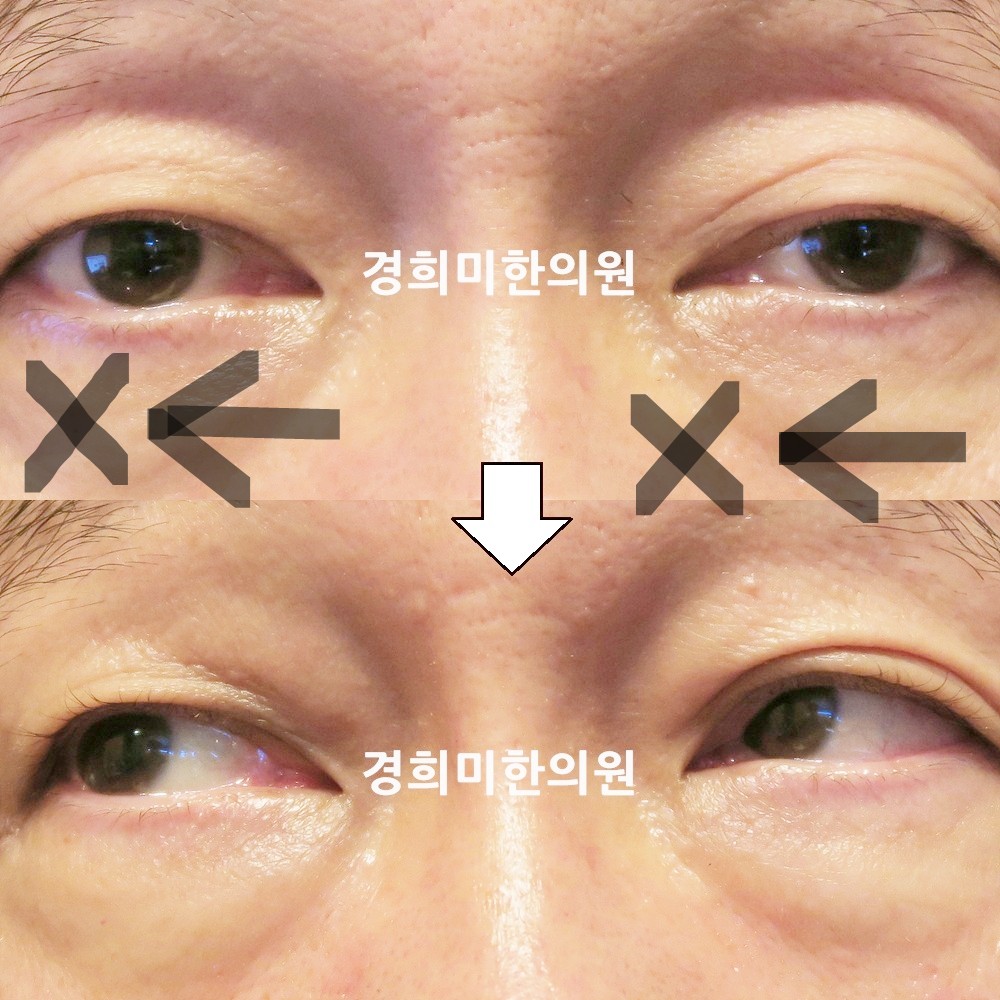 124번-21317-1-강강강-표시.jpg