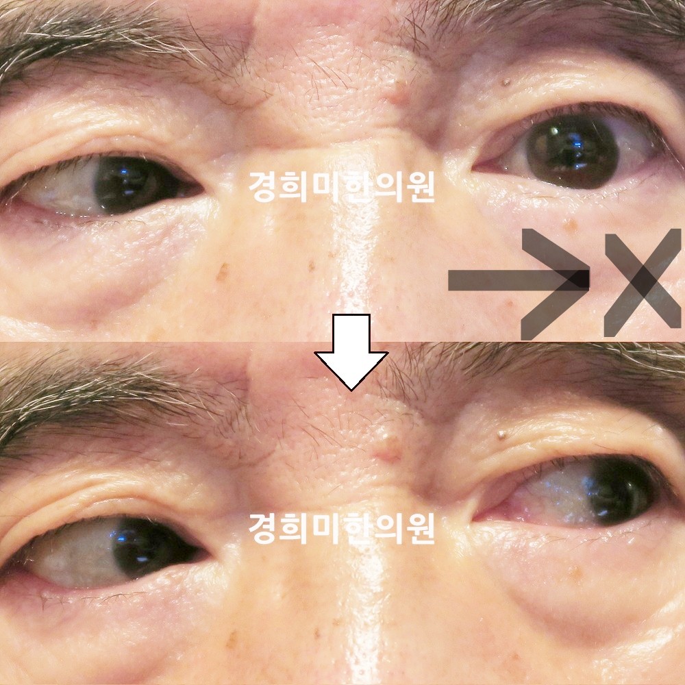 125번-21265-강강강-표시.jpg