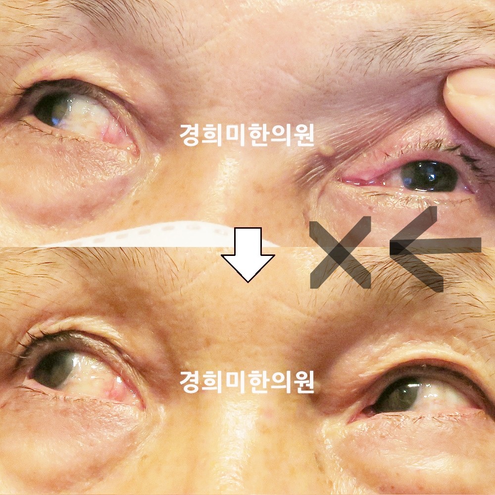 127번-22104-1-강강강-표시.jpg